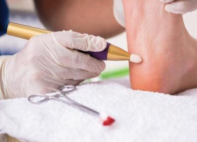 درمان یکی از بیماری های دردناک پا با تزریق چربی